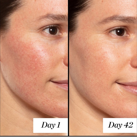 Pick 8/$50 Sunday Riley A+ High-Dose Retinoid Serum🆕deluxe sample size - Picture 5 of 11